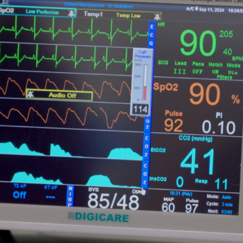 Thumbnail - Monitoring Vitals Under Anesthesia