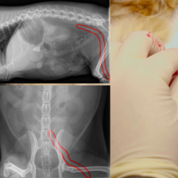 Thumbnail - Placing a PICC Line