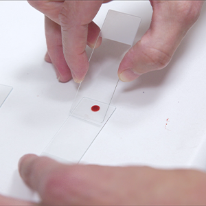 Thumbnail - Creating a Blood Smear Slide