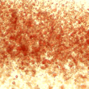 Thumbnail - Diagnostic Test for IMHA - Saline Agglutination Test