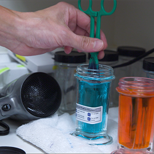 Thumbnail - Dying a Blood Smear Slide