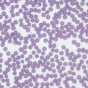 Thumbnail - Reading a Blood Smear Slide